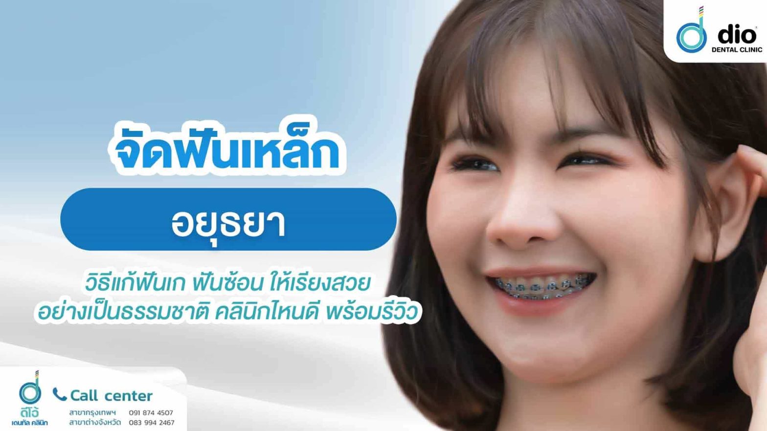 จัดฟันเหล็ก-อยุธยา-วิซ้อน-ให้เรียงสวยอย่างเป็นธรรมชาติ-คลินิกไหนดี-พร้อมรีวิว