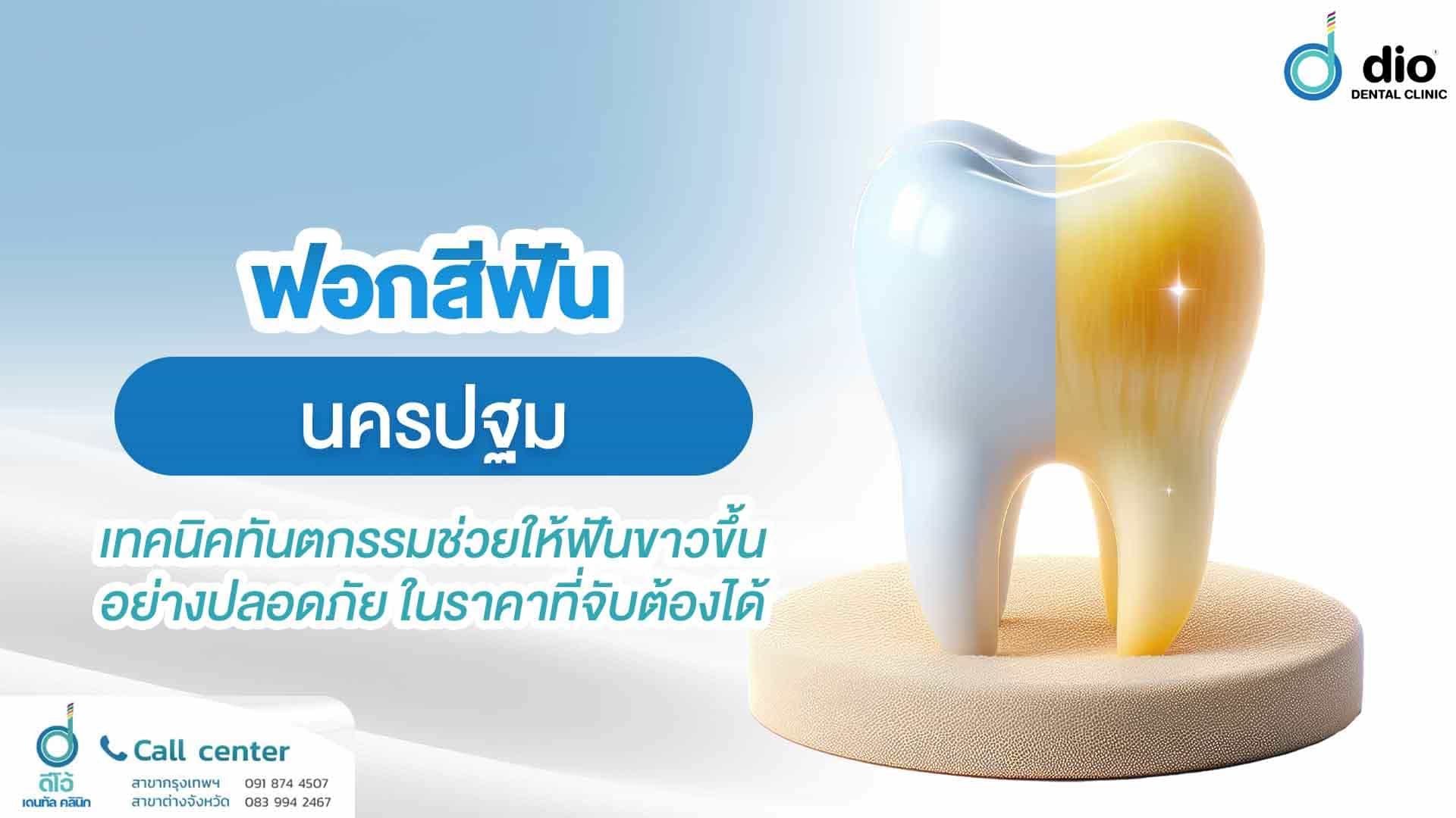 ฟอกสีฟัน-นครปฐม-เทคนิคทันตกรรมช่วยให้ฟันขาวขึ้นอย่างปลอดภัย-ใ