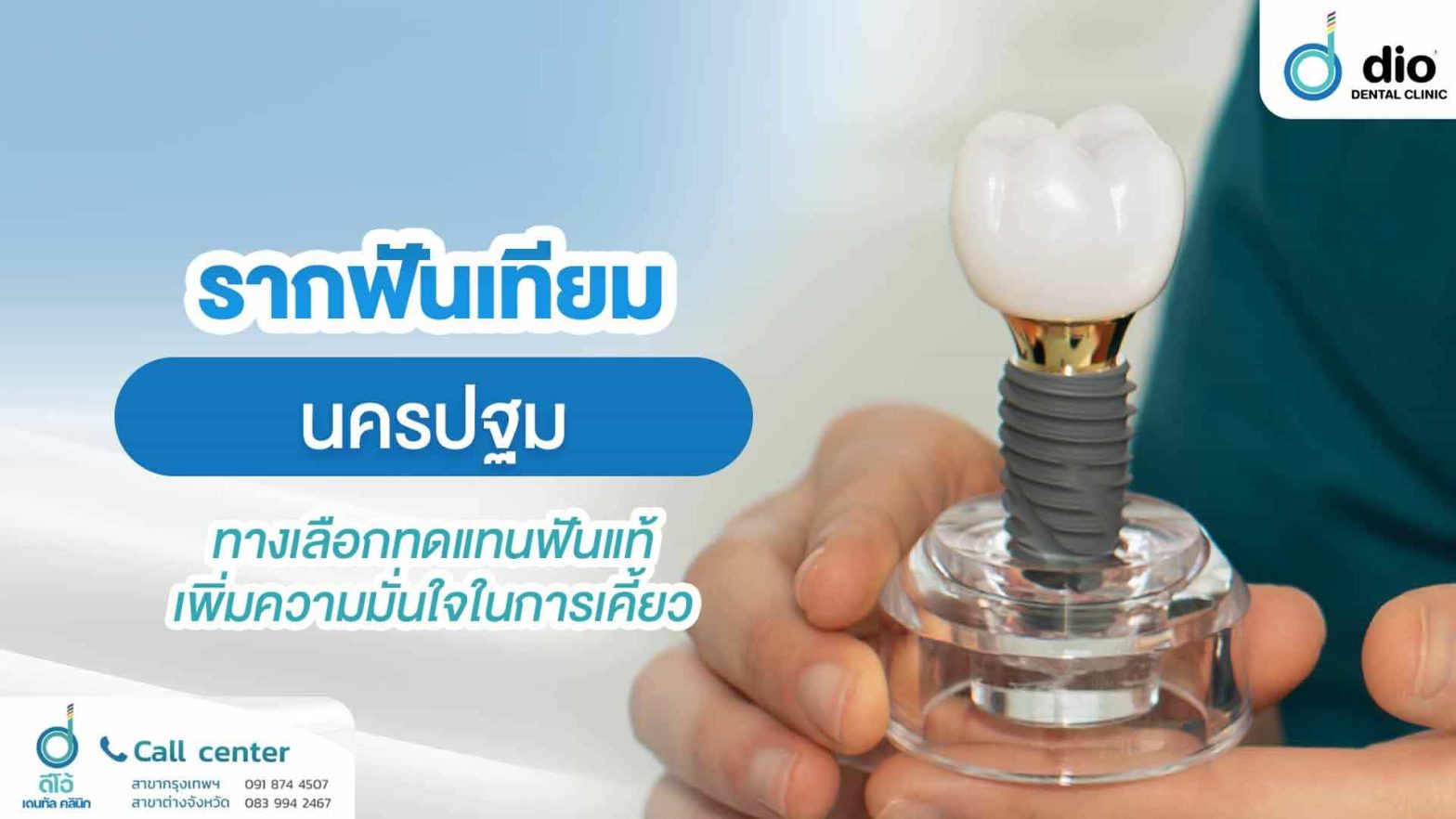 รากฟันเทียม-นครปฐม-ทางเลือกทดแทนฟันแท้-เพิ่มความมั่นใจใ