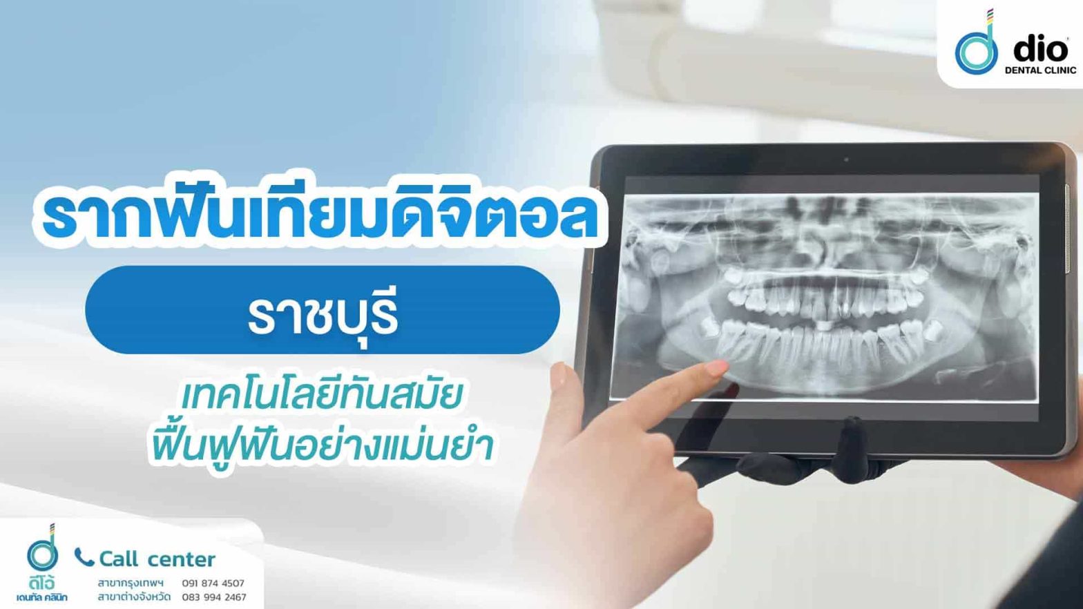 รากฟันเทียมดิจิตอล-ราชบุรี-เทคโนโลยีทันสมัย-ฟื้นฟูฟันอย่างแม่นยำ