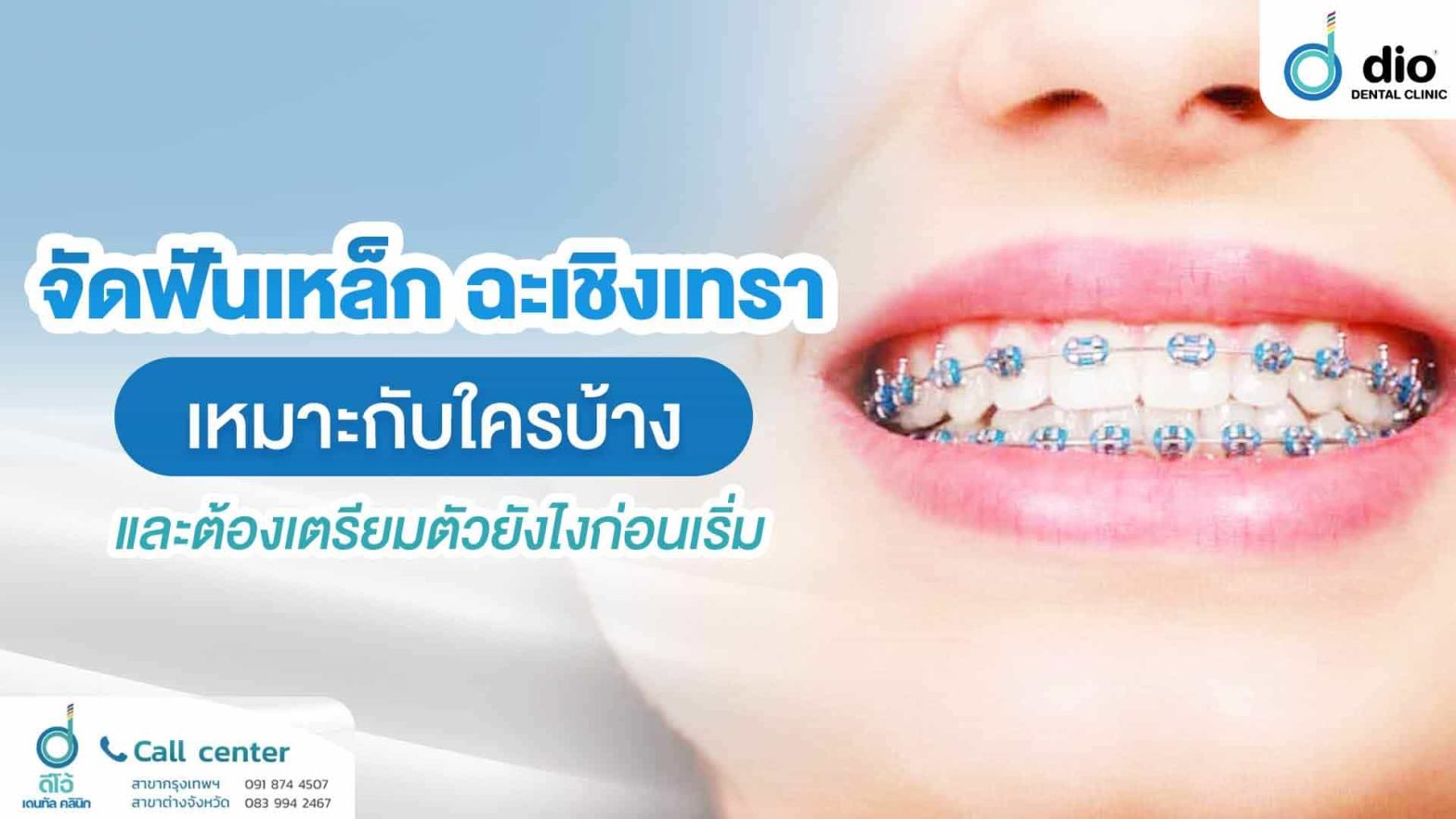 จัดฟันเหล็ก-ฉะเชิงเทรา-เหมาะกับใครบ้าง-และต้องเตรียมตัวยังไงก่อนเริ่ม