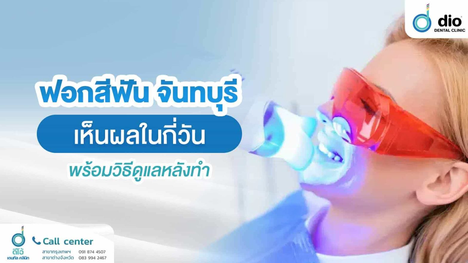 ฟอกสีฟัน-จันทบุรี-เห็นผลในกี่วัน-พร้อมวิธีดูแลหลังทำ