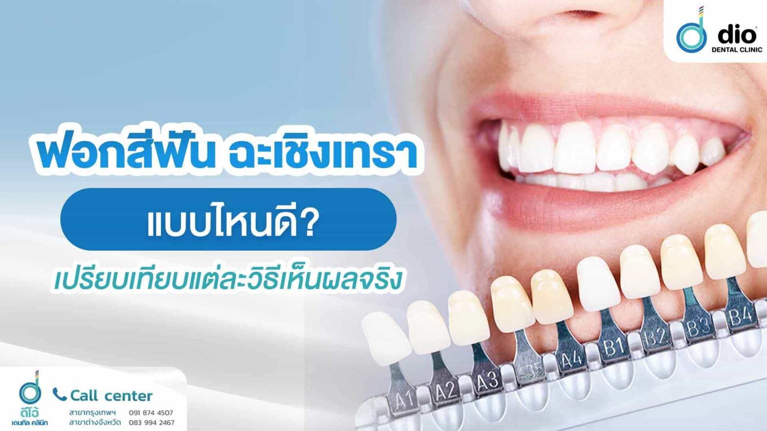 ฟอกสีฟัน-ฉะเชิงเทรา-แบบไหนดี - เปรียบเทียบแต่ละวิธีเห็นผลจริง