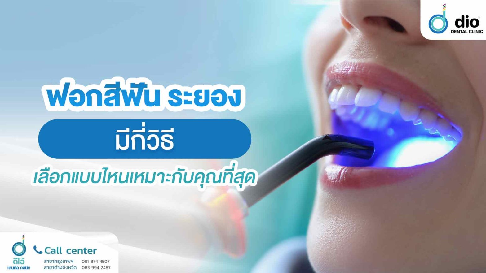ฟอกสีฟัน-ระยอง-มีกี่วิธี-เลือกแบบไหนเหมาะกับคุณที่สุด