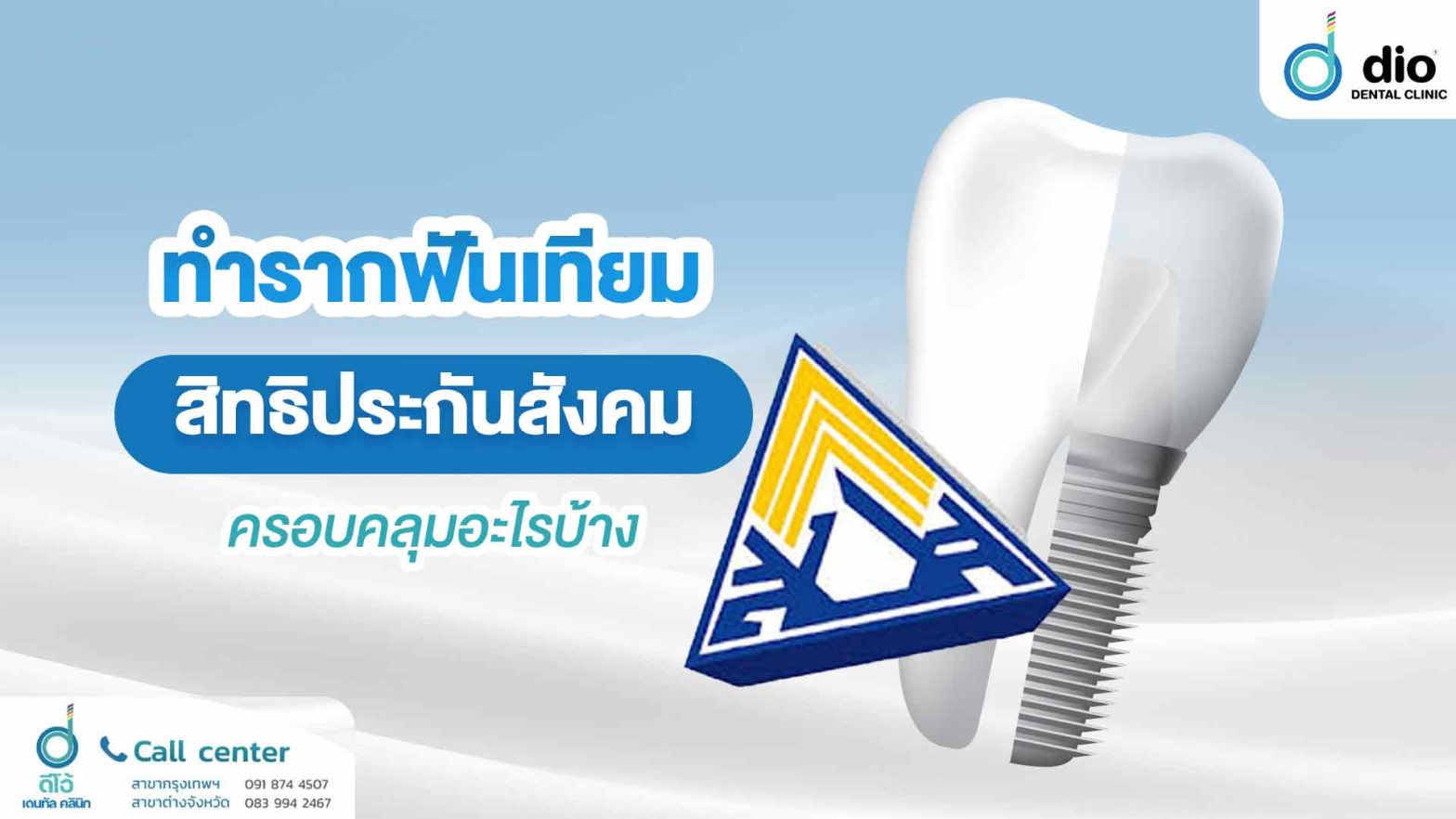 ทำรากฟันเทียม สิทธิประกันสังคมครอบคลุมอะไรบ้าง