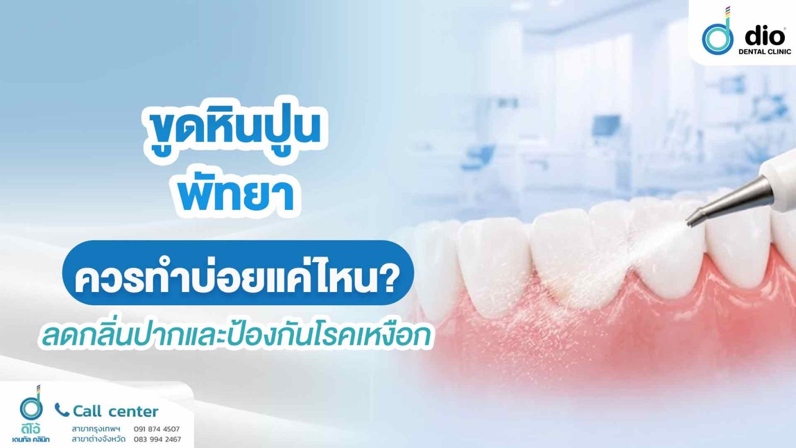 ขูดหินปูน พัทยา ควรทำบ่อยแค่ไหน? ลดกลิ่นปากและป้องกันโรคเหงือก