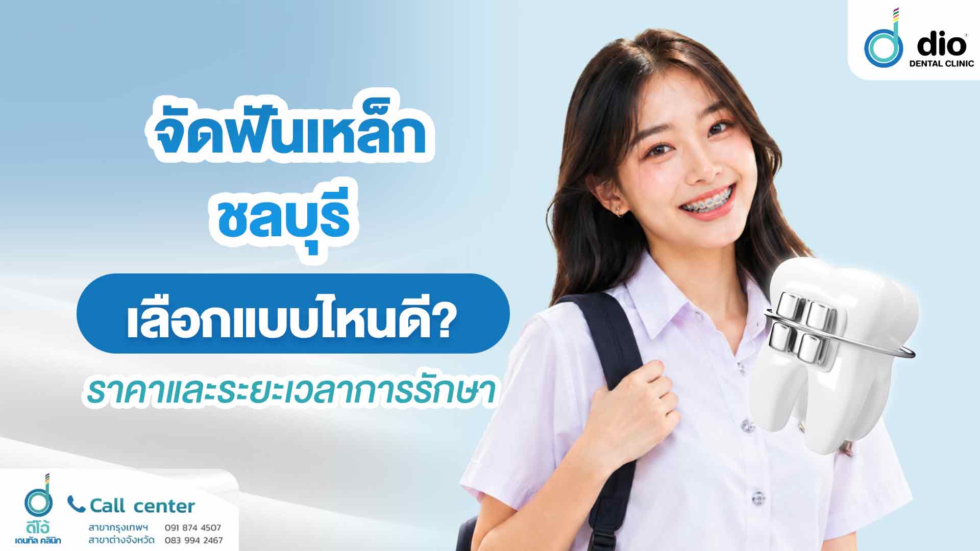 จัดฟันเหล็ก ชลบุรี เลือกแบบไหนดี? ราคาและระยะเวลาการรักษา