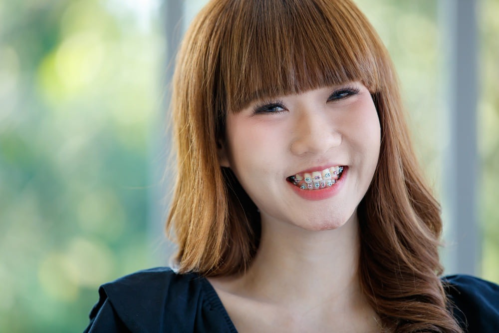 จัดฟันเหล็ก ร้อยเอ็ด