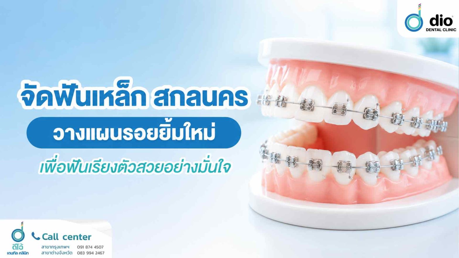 จัดฟันเหล็ก สกลนคร วางแผนรอยยิ้มใหม่เพื่อฟันเรียงตัวสวยอย่างมั่นใจ