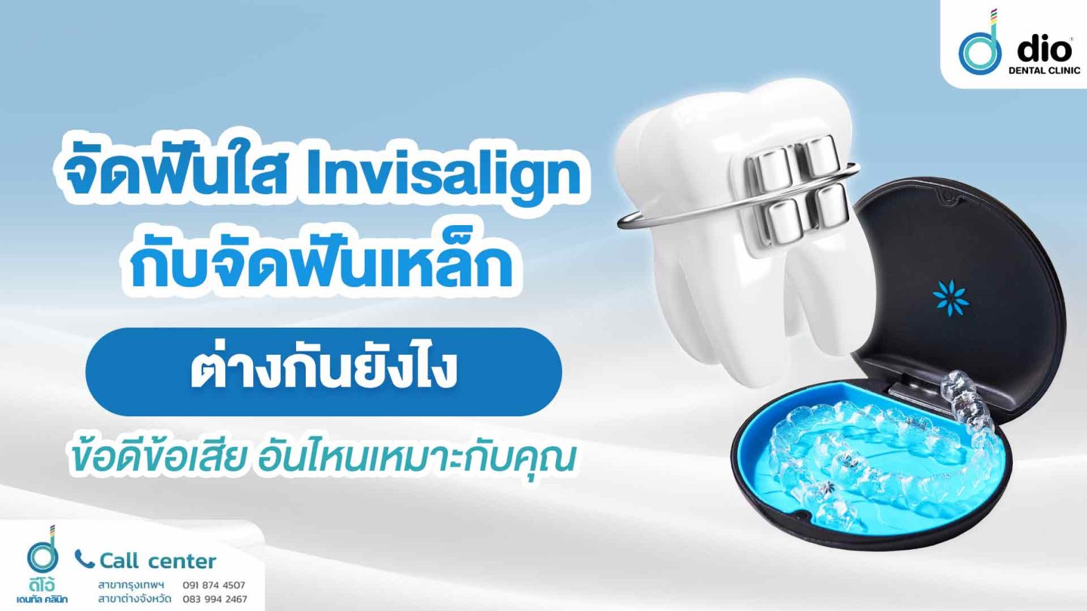 จัดฟันใส Invisalign กับจัดฟันเหล็ก ต่างกันยังไง ข้อดีข้อเสีย อันไหนเหมาะกับคุณ