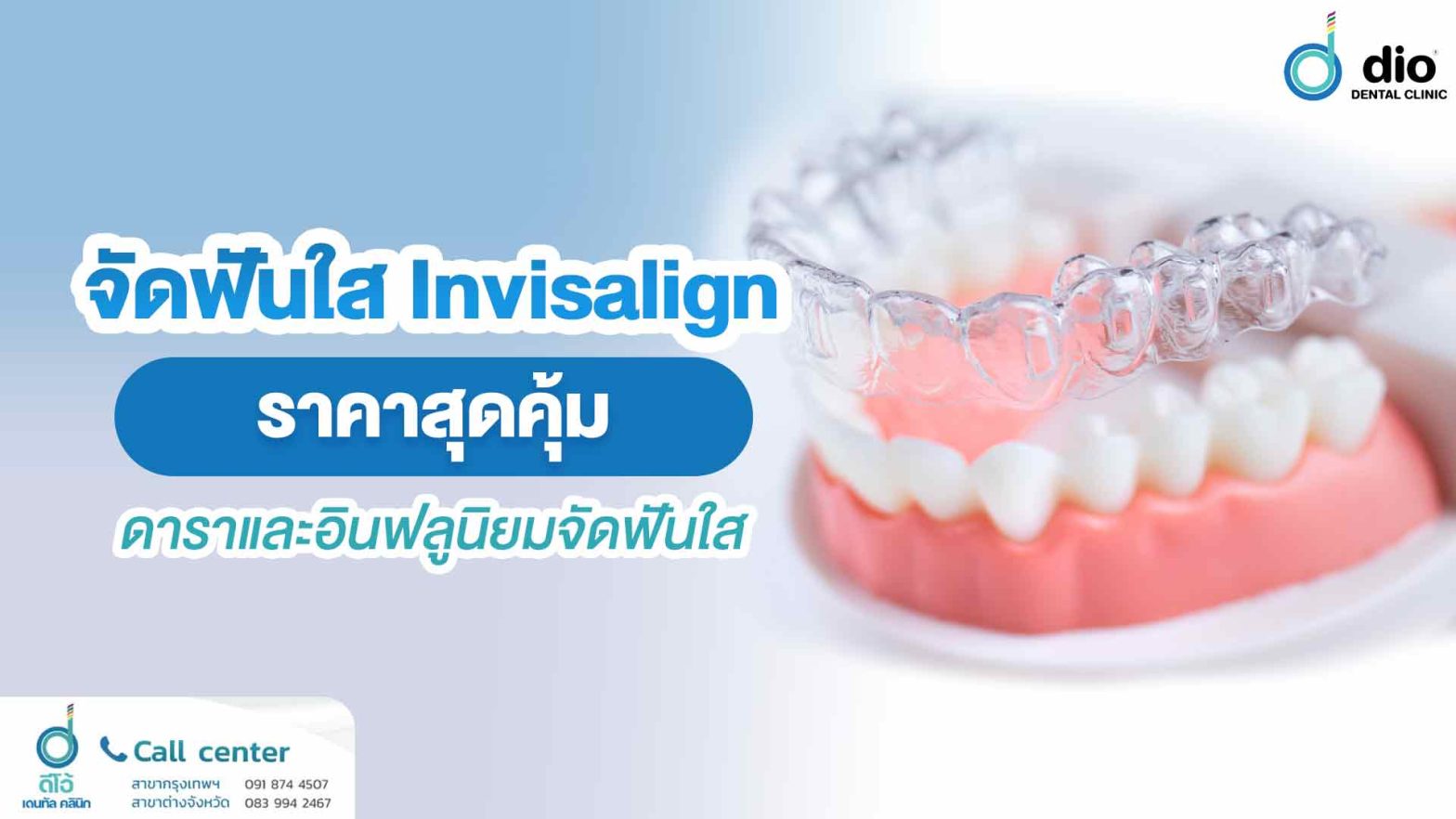 จัดฟันใส Invisalign ราคาสุดคุ้ม ดาราและอินฟลูนิยมจัดฟันใส