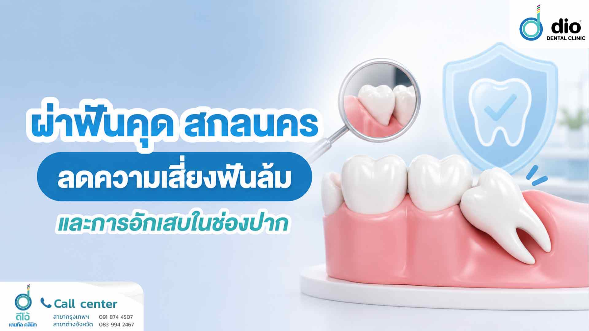 ผ่าฟันคุด สกลนคร ลดความเสี่ยงฟันล้มและการอักเสบในช่องปาก