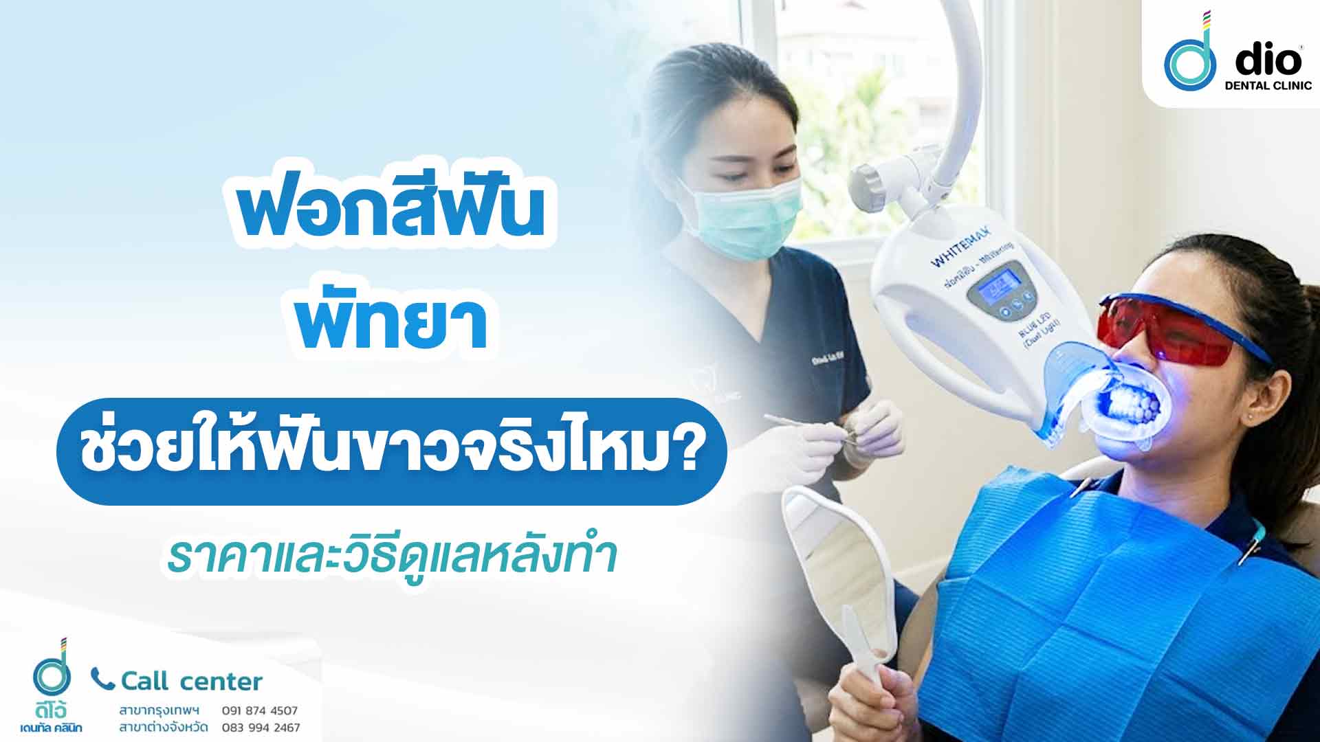 ฟอกสีฟัน พัทยา ฟันขาวจริงไหม ราคาเท่าไหร่และวิธีดูแลหลังทำ