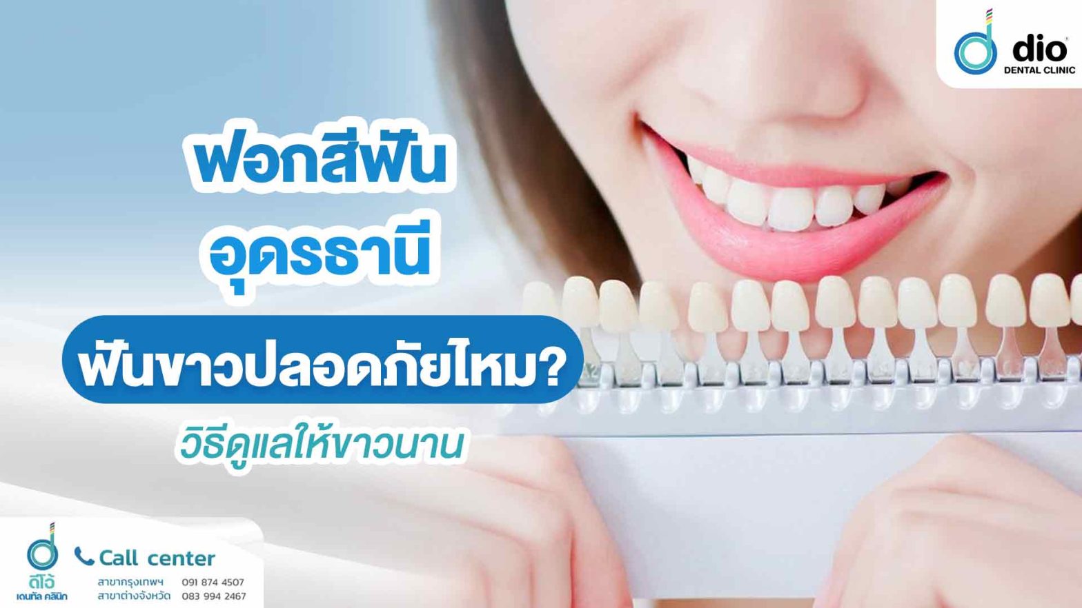 ฟอกสีฟัน อุดรธานี ฟันขาวปลอดภัยไหม? วิธีดูแลให้ขาวนาน