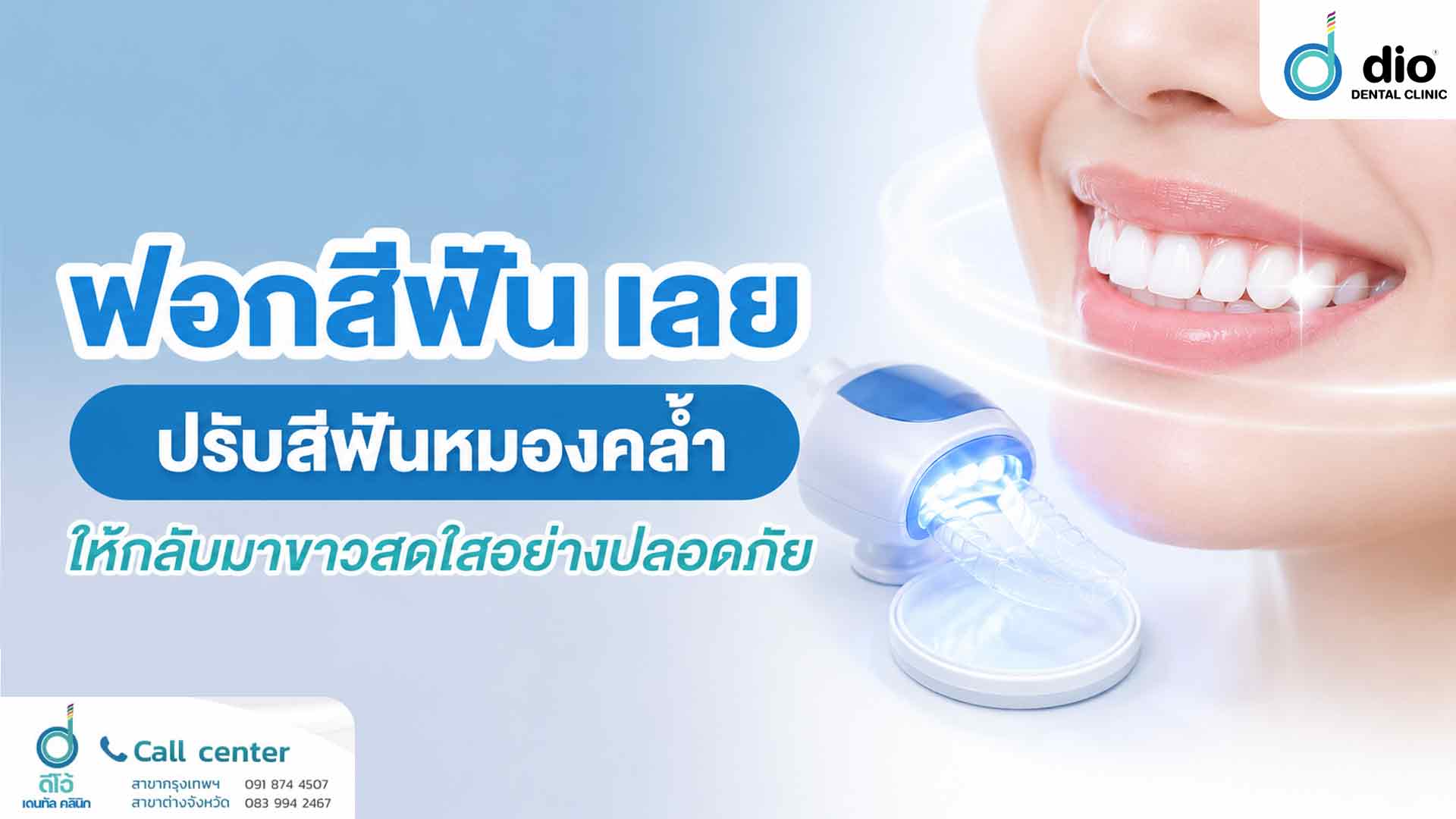ฟอกสีฟัน เลย ปรับสีฟันหมองคล้ำให้กลับมาขาวสดใสอย่างปลอดภัย