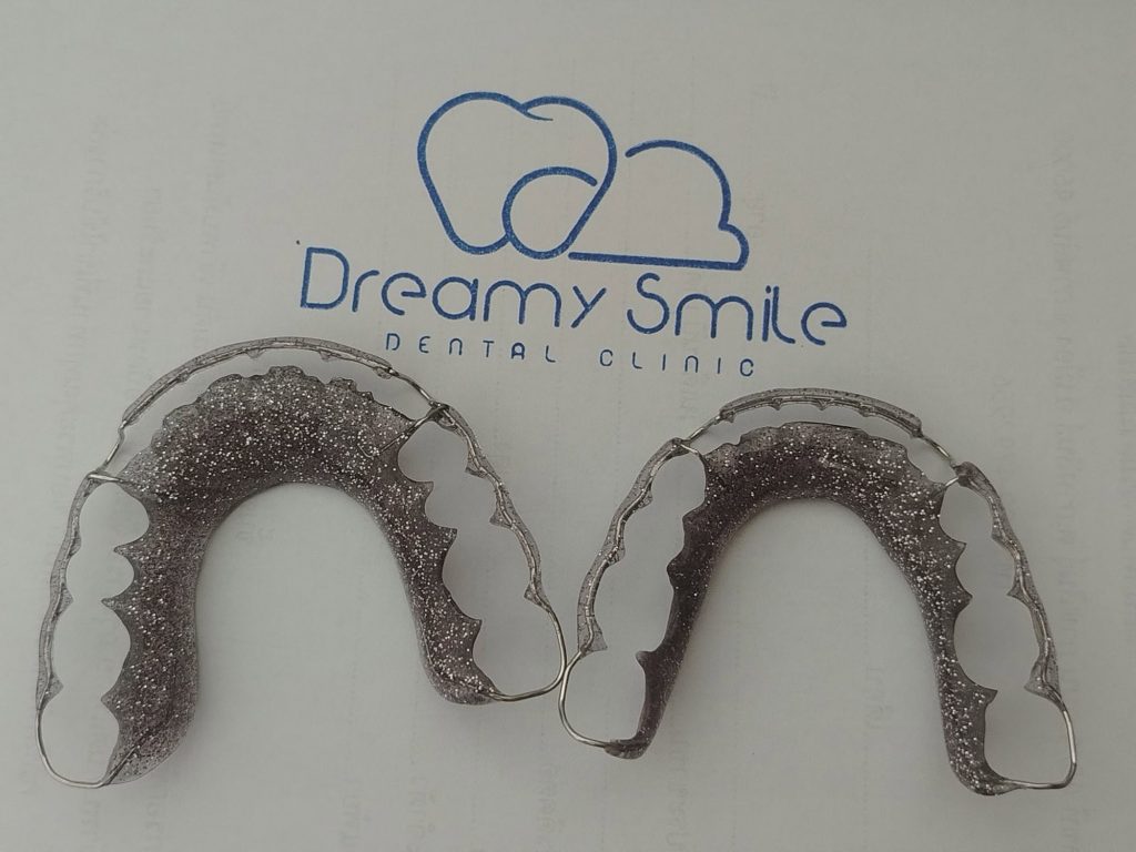 Dreamie smile