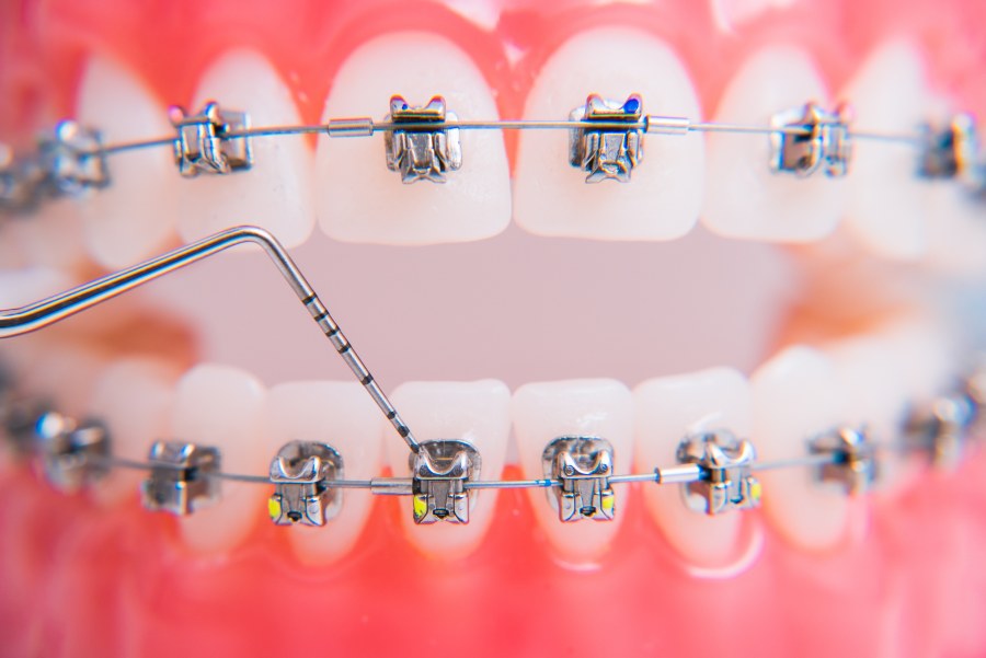 system brackets