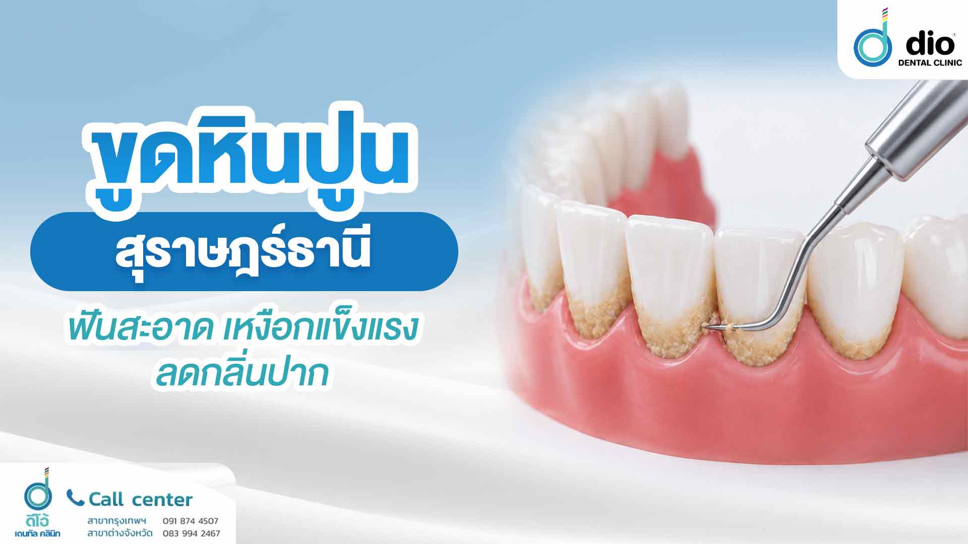 ขูดหินปูน สุราษฎร์ธานี ฟันสะอาด