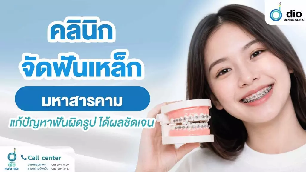 คลินิกจัดฟันเหล็ก มหาสารคาม