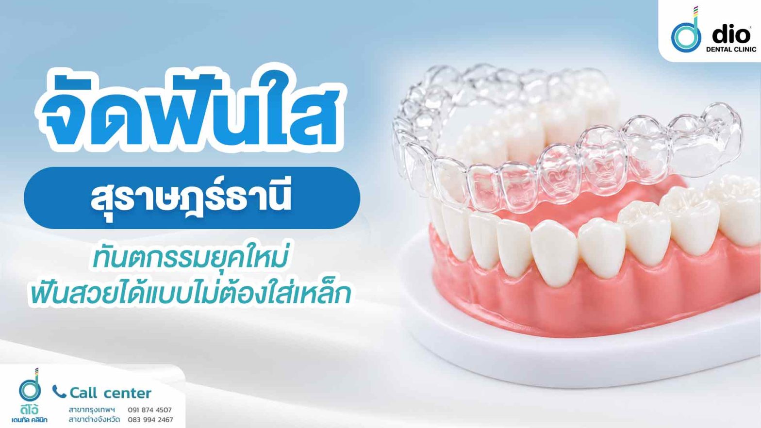 จัดฟันใส-สุราษฎร์ธานี ทันตกรรมยุคใหม่