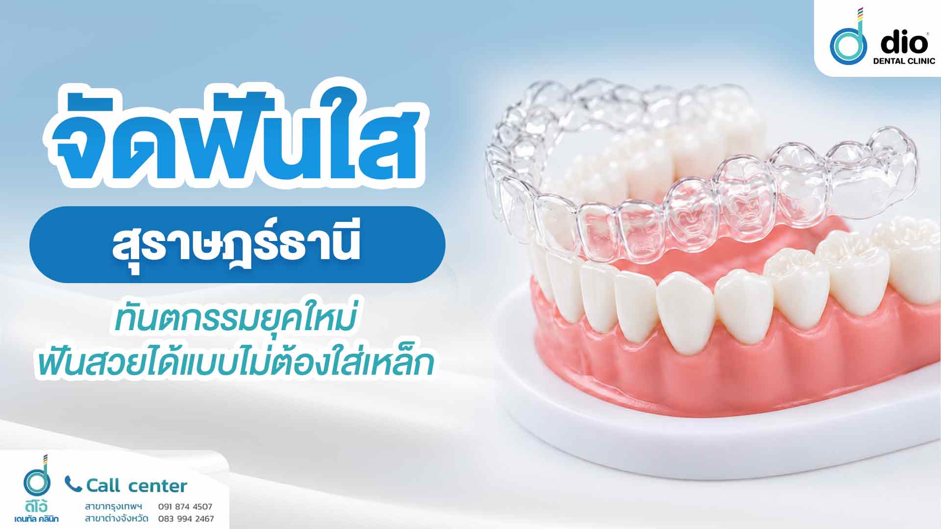จัดฟันใส-สุราษฎร์ธานี ทันตกรรมยุคใหม่