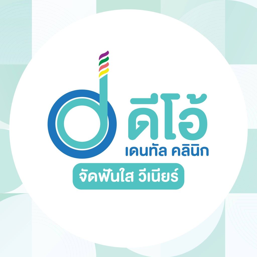 ดีโอเดนทัล จัดฟันใส วีเนียร์