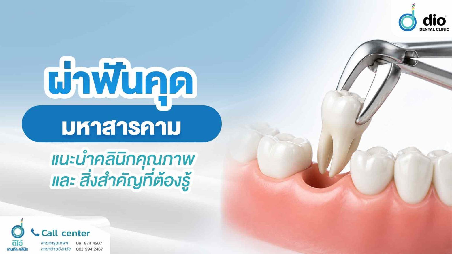 ผ่าฟันคุด มหาสารคาม แนะนำคลินิกคุณภาพ