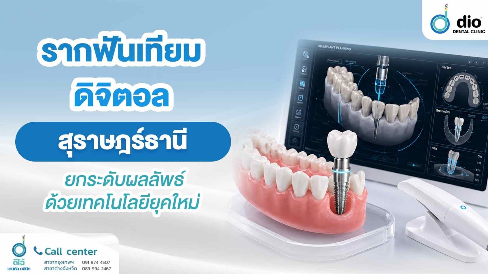 รากฟันเทียมดิจิตอล สุราษฎร์ธานี