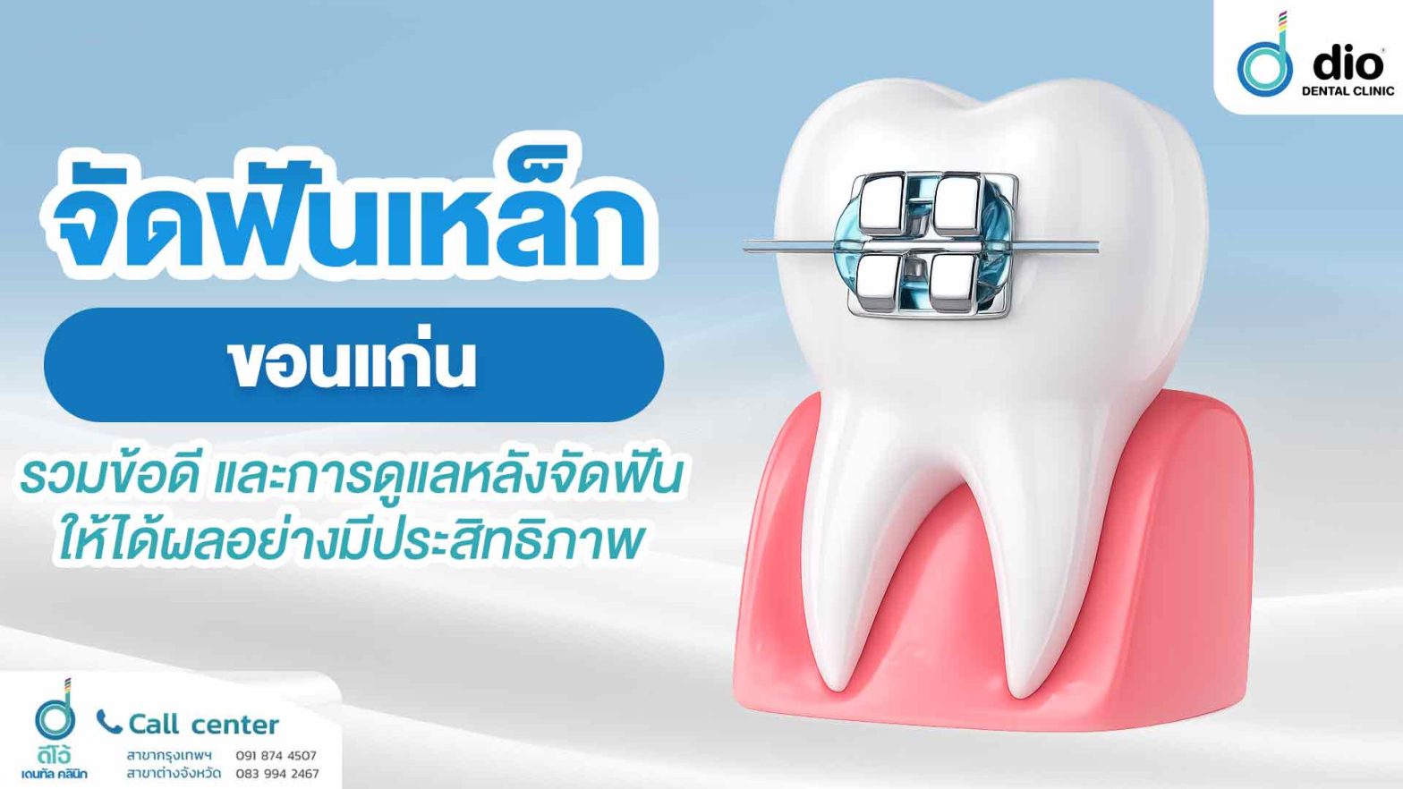จัดฟันเหล็ก ขอนแก่น