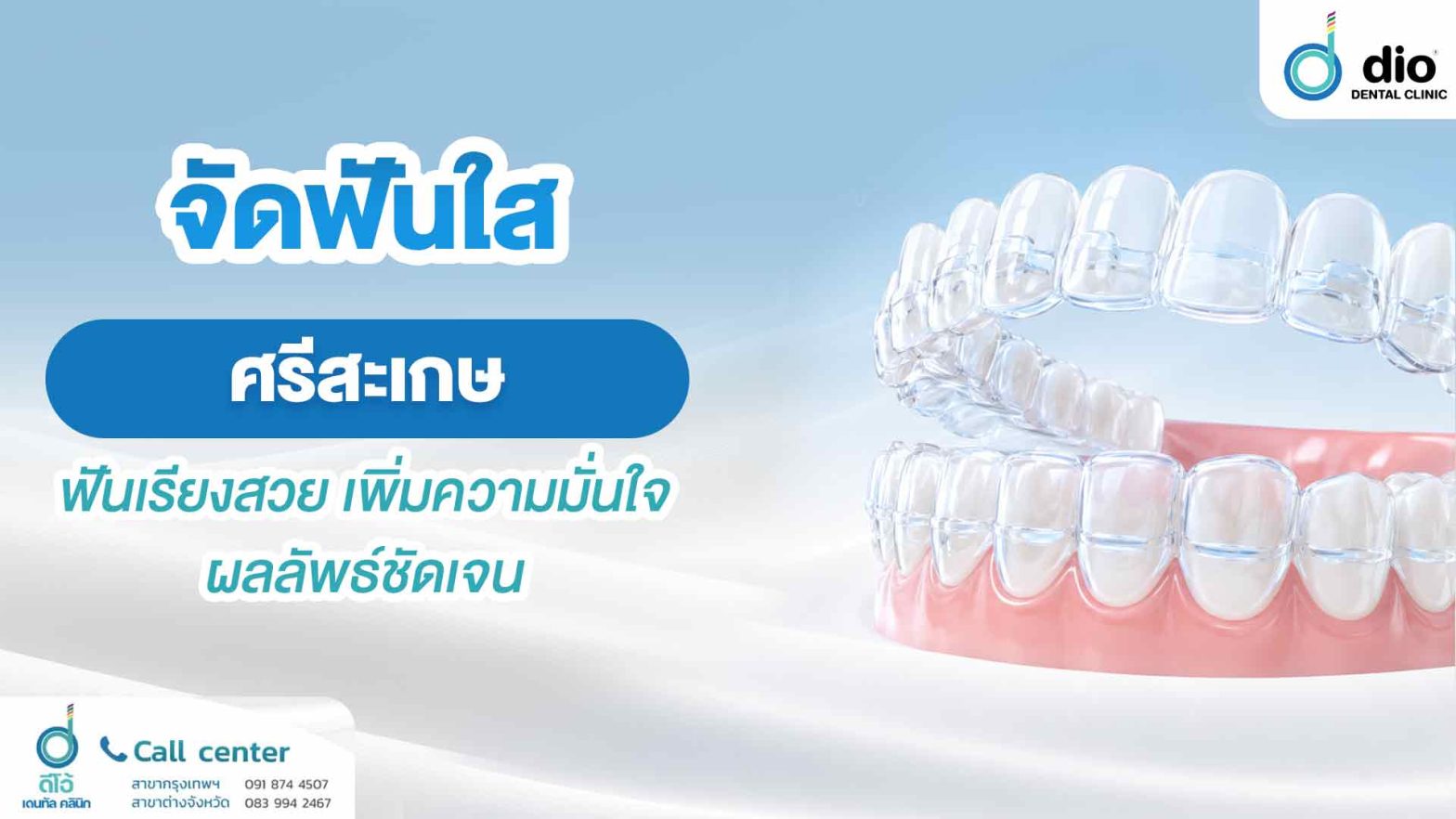 จัดฟันใส ศรีสะเกษ