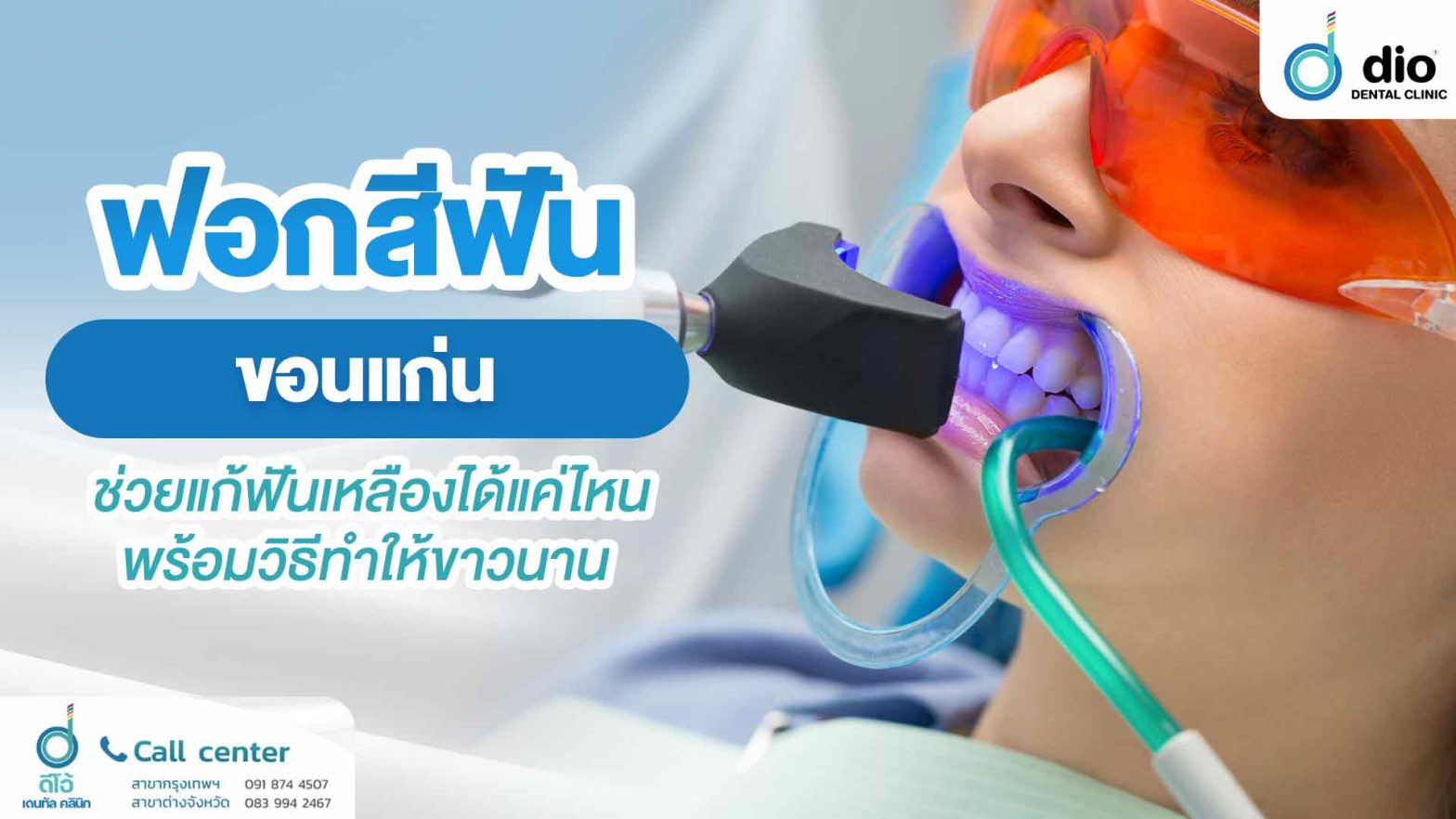 ฟอกสีฟัน ขอนแก่น