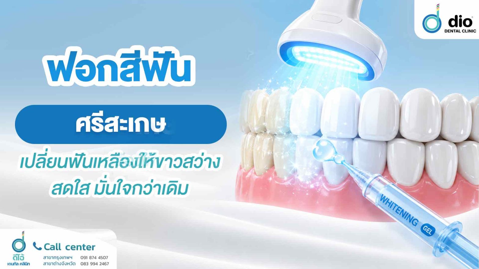 ฟอกสีฟัน ศรีสะเกษ