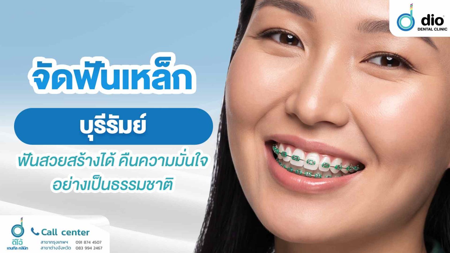 จัดฟันเหล็ก บุรีรัมย์ ฟันสวยสร้างได้ คืนความมั่นใจอย่างเป็นธรรมชาติ
