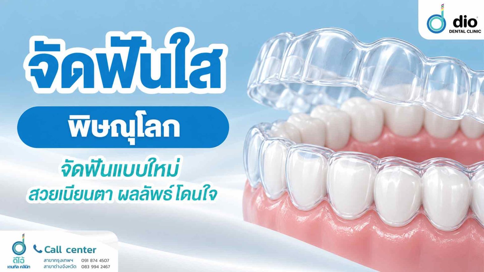 จัดฟันใส พิษณุโลก จัดฟันแบบใหม่ สวยเนียนตา ผลลัพธ์โดนใจ