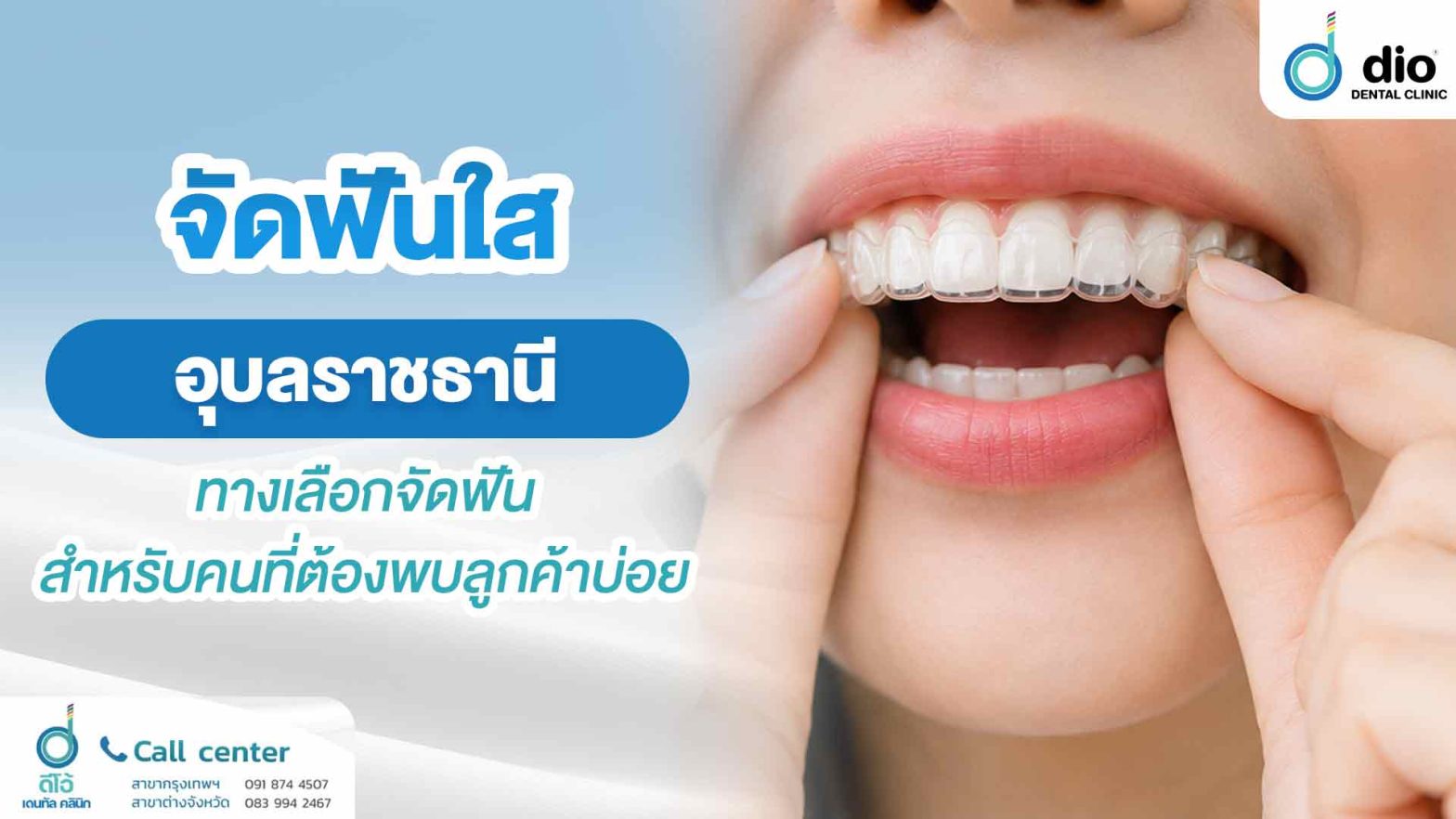 จัดฟันใส สุรินทร์ แก้ปัญหาฟันไม่เข้ารูป ช่วยให้ฟันเรียงสวย เห็นผลชัดเจน