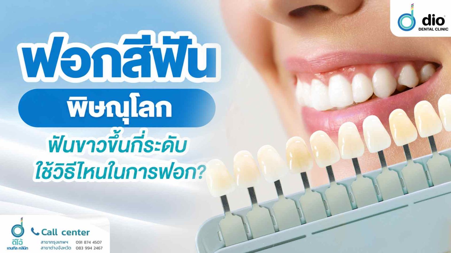 ฟอกสีฟัน พิษณุโลก ฟันขาวขึ้นกี่ระดับ ใช้วิธีไหนในการฟอก