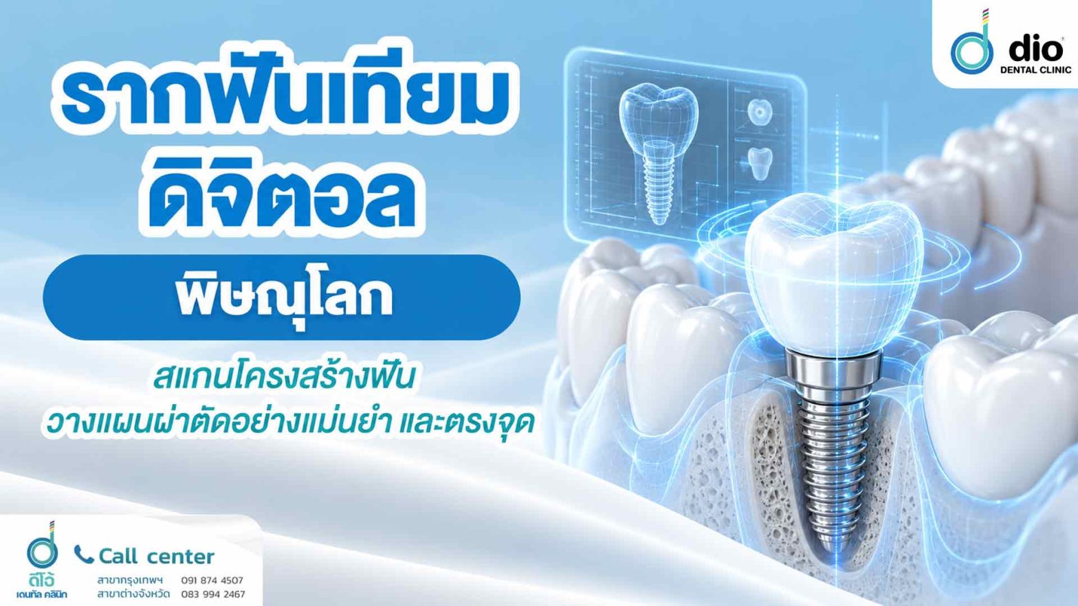 รากฟันเทียมดิจิตอล พิษณุโลก สแกนโครงสร้างฟัน วางแผนผ่าตัดอย่างแม่นยำ และตรงจุด