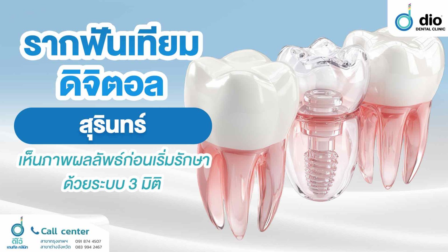รากฟันเทียมดิจิตอล สุรินทร์ เห็นภาพผลลัพธ์ก่อนเริ่มรักษา ด้วยระบบ 3 มิติ