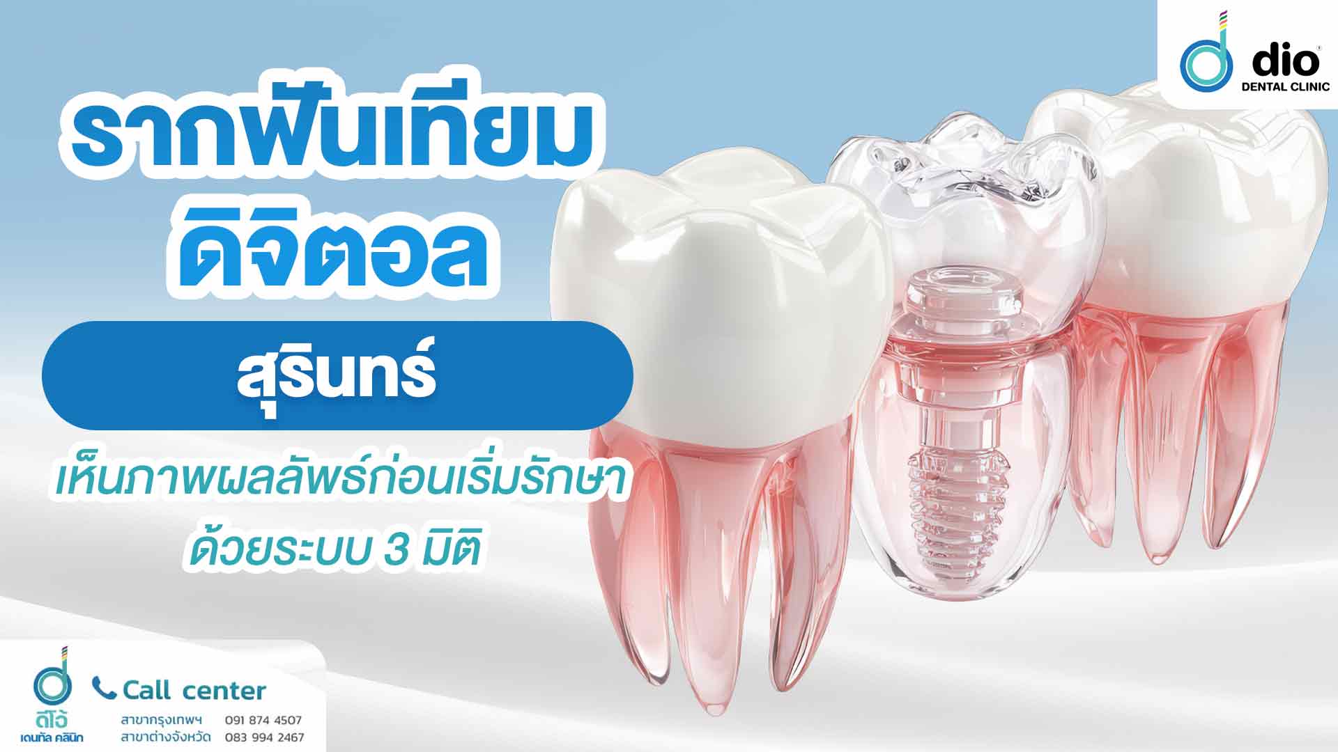 รากฟันเทียมดิจิตอล สุรินทร์ เห็นภาพผลลัพธ์ก่อนเริ่มรักษา ด้วยระบบ 3 มิติ